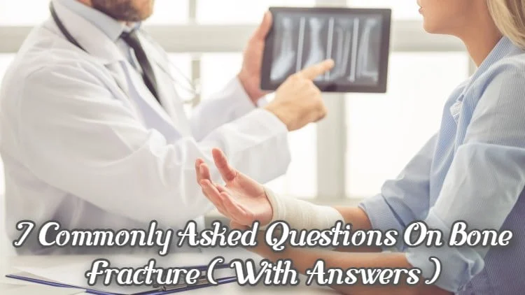 7 Commonly Asked Questions on Bone Fracture (With Answers)